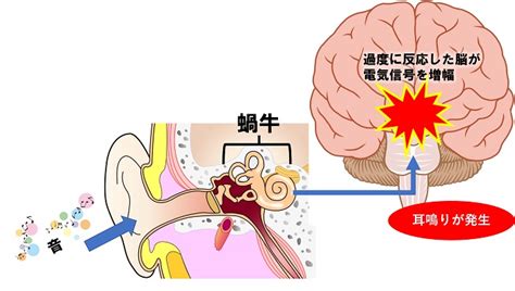 右耳 耳鳴|【左耳/右耳だけ】片耳の耳鳴りが続く理由とは？原因となる病。